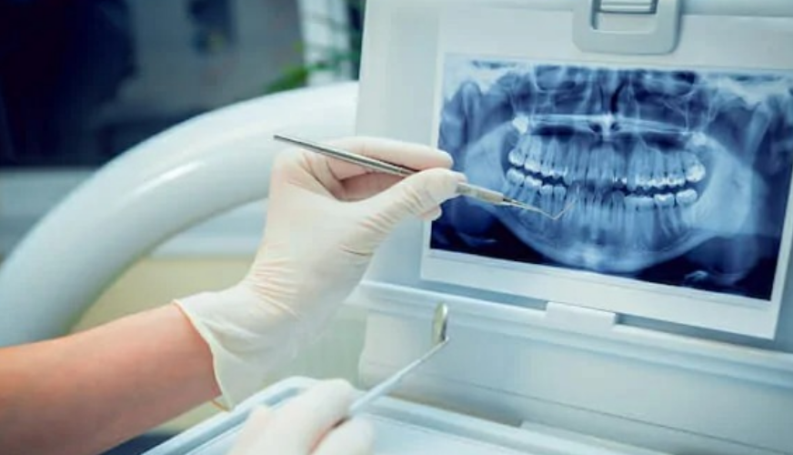 The Advantages of Digital Dental X-rays: A Modern Approach to Oral Health