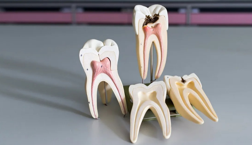 Root Canal Treatment